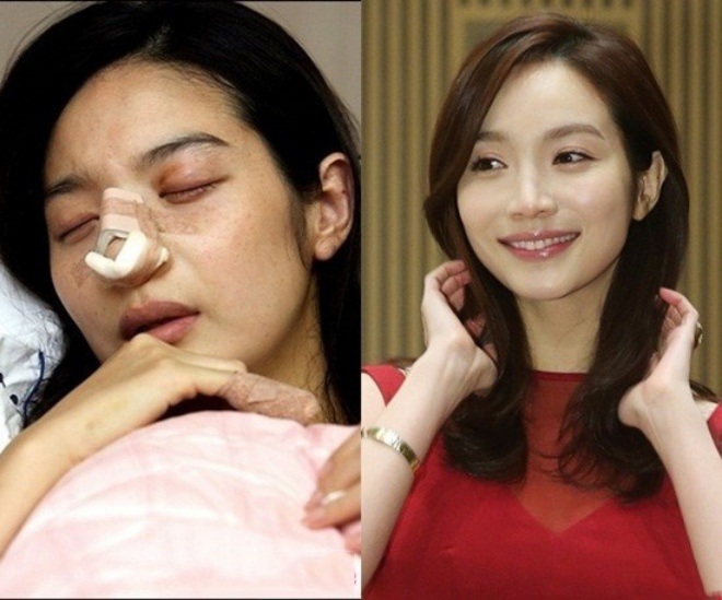 Những Trải Nghiệm Đau Đớn